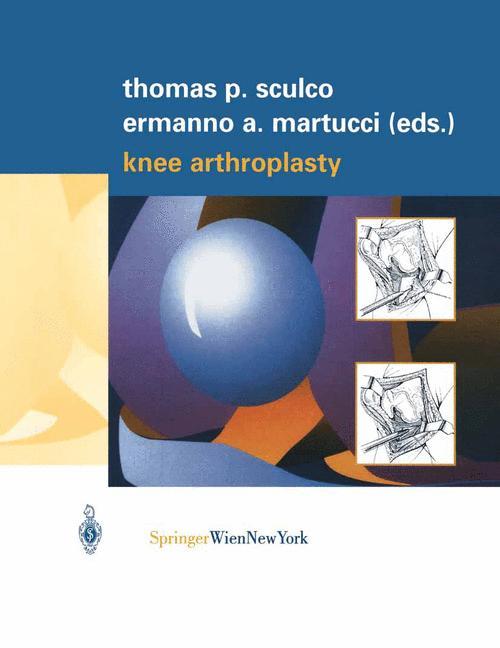 Knee Arthroplasty