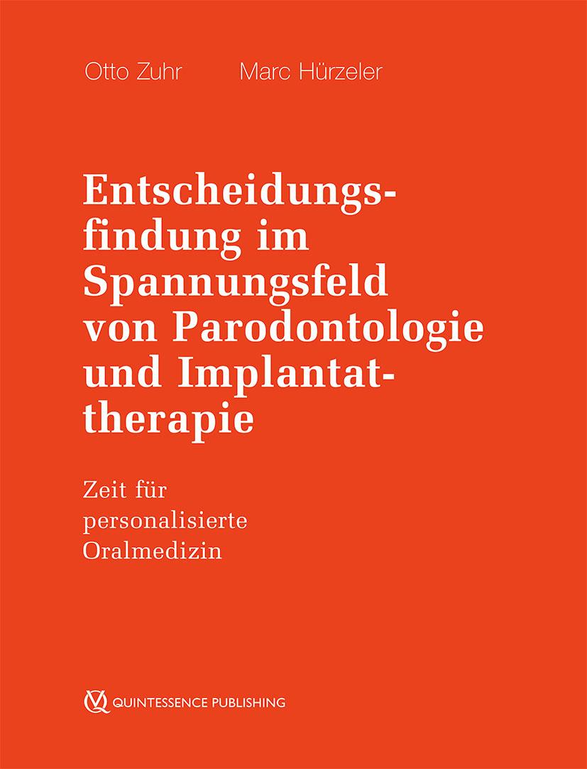 Entscheidungsfindung im Spannungsfeld von Parodontologie und Implantattherapie