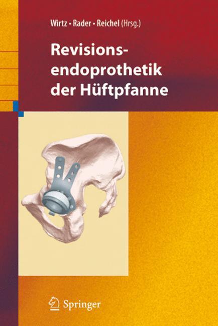 Revisionsendoprothetik der Hüftpfanne