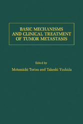 Basic Mechanisms and Clinical Treatment of Tumor Metastasis