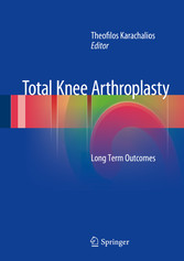 Total Knee Arthroplasty