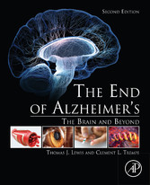 The End of Alzheimer's