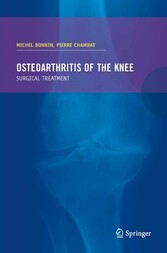 Osteoarthritis of the knee