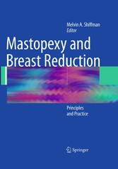 Mastopexy and Breast Reduction