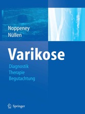 Varikose