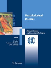 Musculoskeletal Diseases