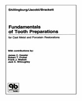 Fundamentals of Tooth Preparations for Cast Metal and Porcelain Restorations