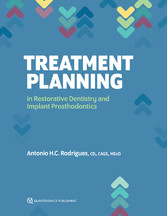 Treatment Planning in Restorative Dentistry and Implant Prosthodontics