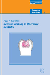 Decision-Making in Operative Dentistry