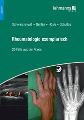 Rheumatologie exemplarisch