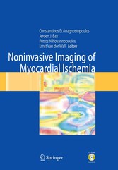 Noninvasive Imaging of Myocardial Ischemia