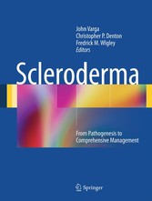 Scleroderma