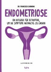 Endometriose