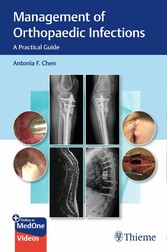 Management of Orthopaedic Infections