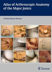 Atlas of Arthroscopic Anatomy of the Major Joints