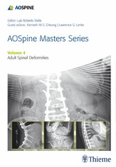 AOSpine Masters Series, Volume 4: Adult Spinal Deformities