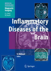 Inflammatory Diseases of the Brain