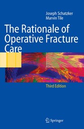 The Rationale of Operative Fracture Care