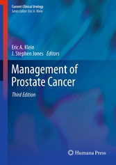 Management of Prostate Cancer