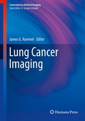 Lung Cancer Imaging